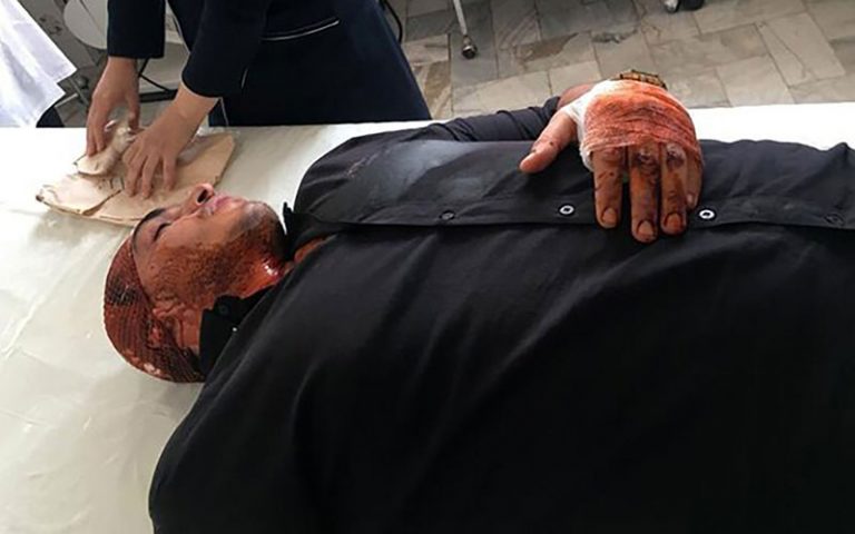 حمله-اوباش-تهرانی-به-قهرمان-بوکس-المپیکی-ایران