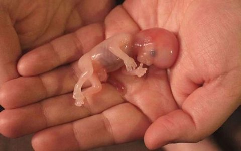 هر روز چه تعداد جنین در ایران سقط می‌شود؟