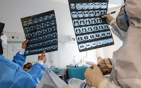 شناسایی 2279 مبتلای جدید به کرونا/فوت 139 بیمار در 24 ساعت 1 شناسایی 2279 مبتلای جدید به کرونا/فوت 139 بیمار در 24 ساعت شناسایی 2279 مبتلای جدید به کرونا سیما سادات لاری