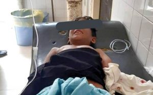 گاندو‌-دست‌-پسر‌-بچه‌-چابهاری‌-را‌-خورد
