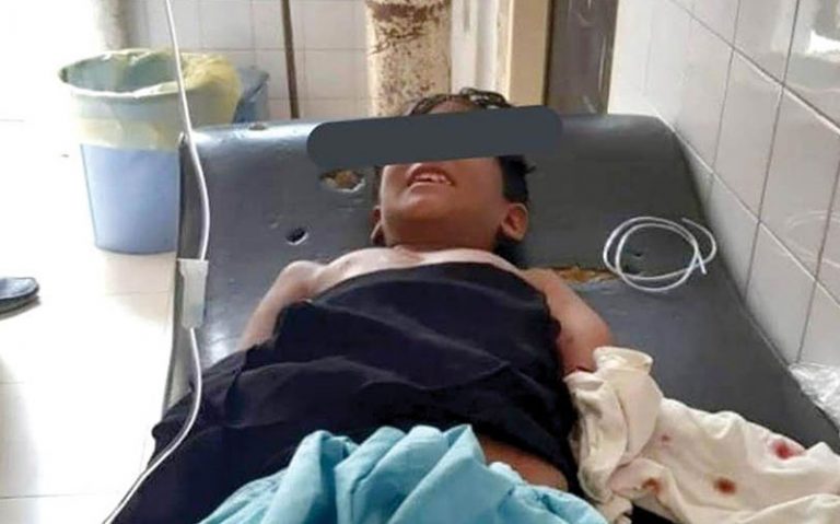 گاندو‌-دست‌-پسر‌-بچه‌-چابهاری‌-را‌-خورد