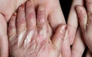 تحریم‌های-آمریکا-سلاحی-علیه-جان-کودکان-بی‌گناه-است