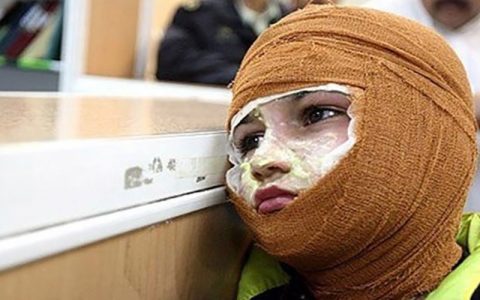 اورژانس: حوادث مرتبط با چهارشنبه سوری تاکنون ۳ فوتی داشته؛ ۲ نفر در بانه و یک دختر ۶ ساله در تبریز اورژانس: حوادث مرتبط با چهارشنبه سوری تاکنون ۳ فوتی داشته؛ ۲ نفر در بانه و یک دختر ۶ ساله در تبریز