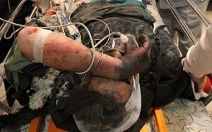 ۲-نفر-در-مشگین-شهر-بر-اثر-انفجار-مواد-محترقه-مصدوم-شدند