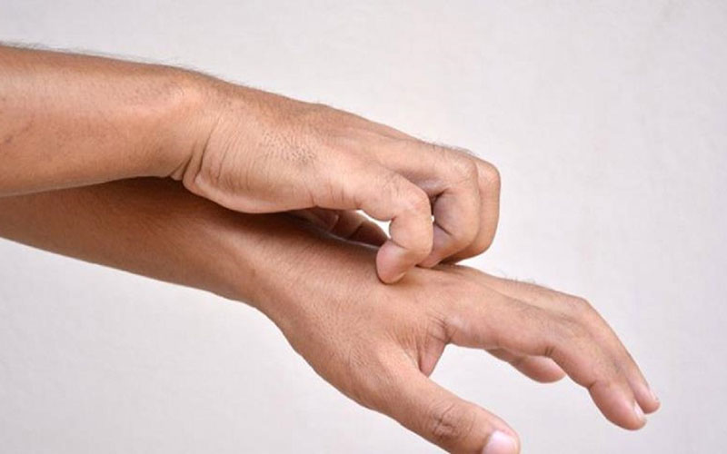 علائم جدید کرونا که روی پوست
