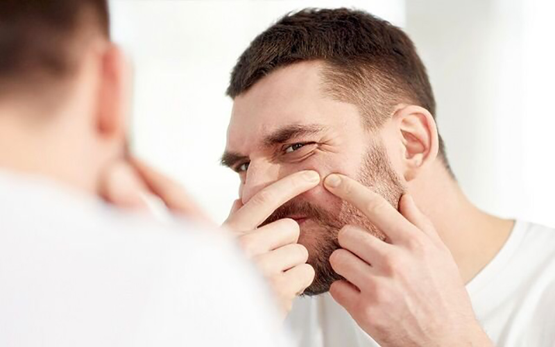 ۵ ویژگی اصلی جوش‌های هورمونی را بشناسیم