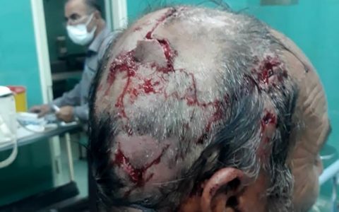 خرس به مرد بروجنی حمله کرد 1 خرس به مرد بروجنی حمله کرد