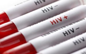 درمان آزمایشی HIV وارد تست انسانی شد