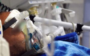 آخرین وضعیت بروز قارچ سیاه در بیماران کرونا