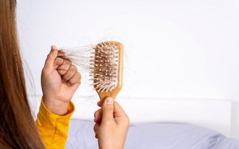 این غذاها را نخورید تا ریزش مو نگیرید 1 این غذاها را نخورید تا ریزش مو نگیرید