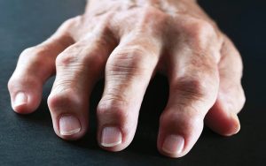 نوشیدنی که علائم التهاب مفصل را کاهش می‌دهد