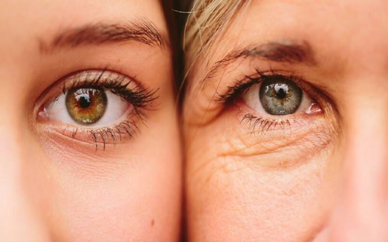 چروک‌های پوست صورت از یک بیماری مرگبار خبر می‌دهند؟