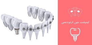 ایمپلنت حین ارتودنسی