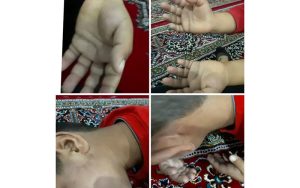 شکنجه دانش آموز کلاس اول توسط معلم