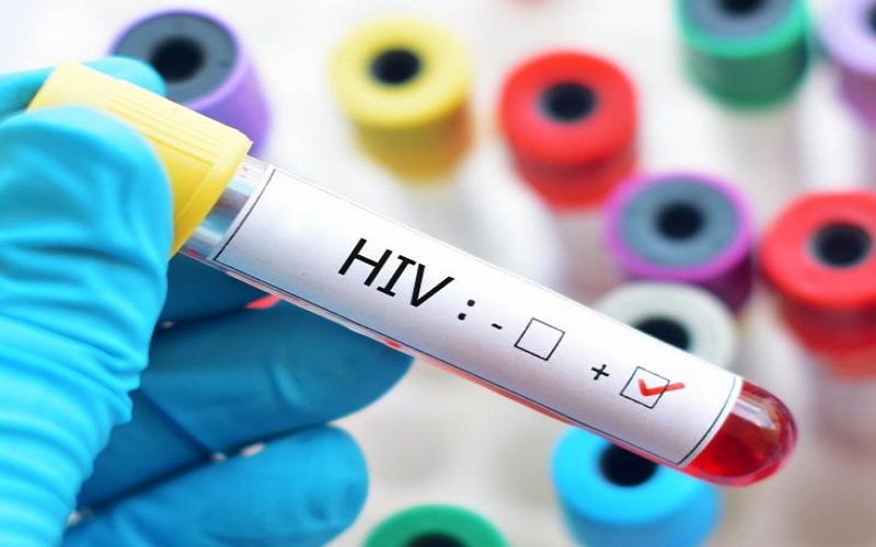 اولین داروی تزریقی برای جلوگیری از اچ.آی.وی تایید شد
