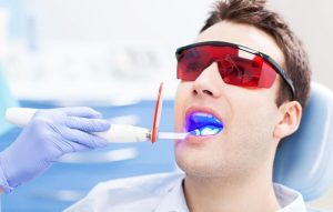 معرفی بهترین دندانپزشک بلیچینگ دندان در تهران