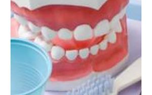 عواقب خطرناک مسواک نزدن که باید بدانیم