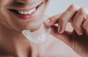 معرفی بهترین دندانپزشک بلیچینگ دندان در تهران