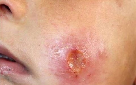 شیوع بیماری عجیب در ساوه 1 شیوع بیماری عجیب در ساوه