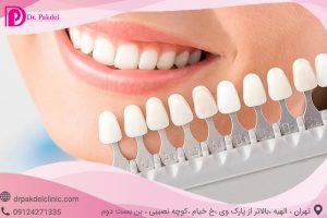 Dental-composite-12