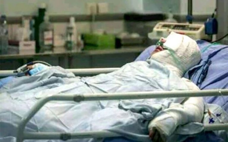 ترقه دستان نوجوان شیرازی را قطع کرد