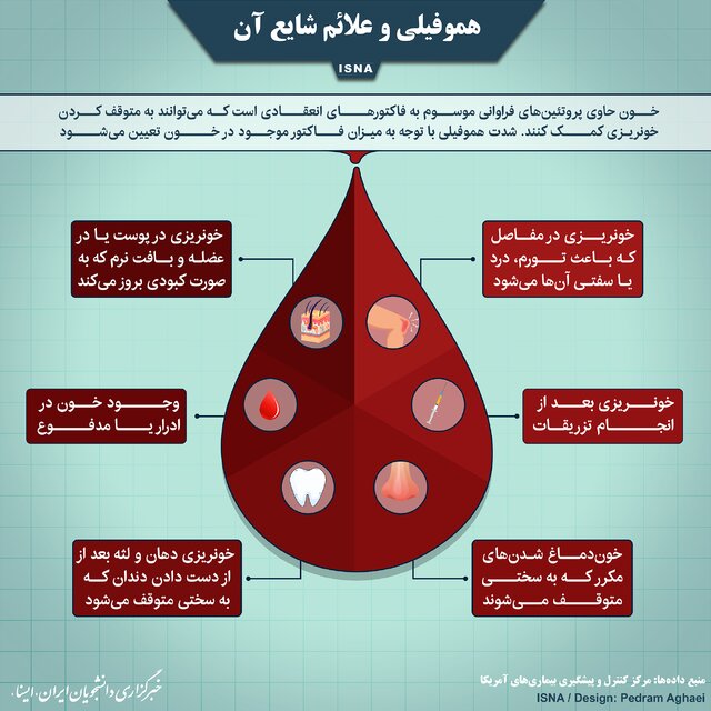 هموفیلی 