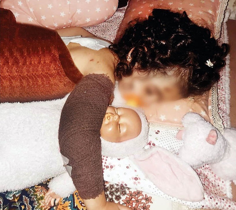 حمله سگ های ولگرد دختر بچه 3 ساله 