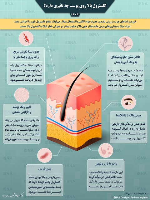 تاثیر کلسترول بالا روی پوست