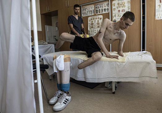 سرباز 19 ساله قطع عضو شده اوکراینی در حال دریافت خدمات پزشکی در یک مرکز درمانی در شهر "کی یف" اوکراین