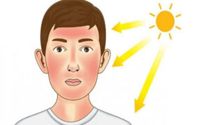 جلوگیری از آفتاب سوختگی با چند ماده غذایی