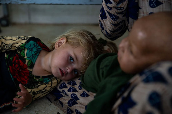 بیماران بستری در بخش کودکان بیمارستان "ایندیرا گاندی" در شهر کابل افغانستان