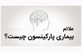 با ۱۰ نشانه پارکینسون آشنا شوید