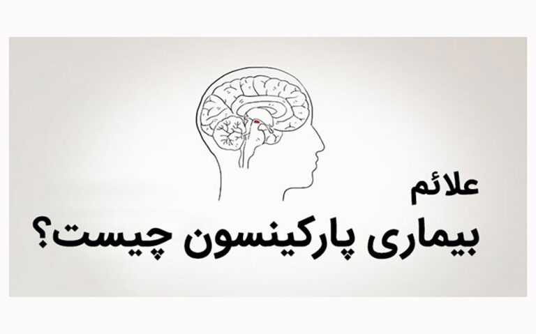 با ۱۰ نشانه پارکینسون آشنا شوید