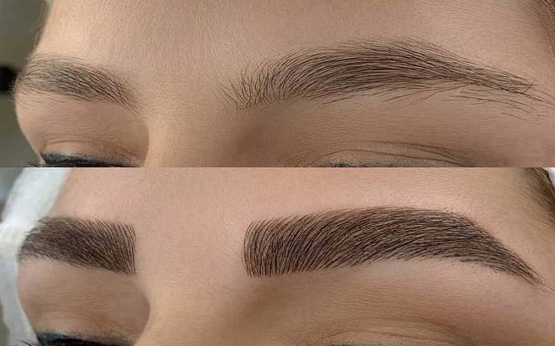 فیبروز ابرو چیست؟ بررسی مزایا و معایب فیبروز