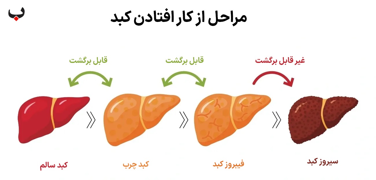مراحل از کار افتادن کبد
