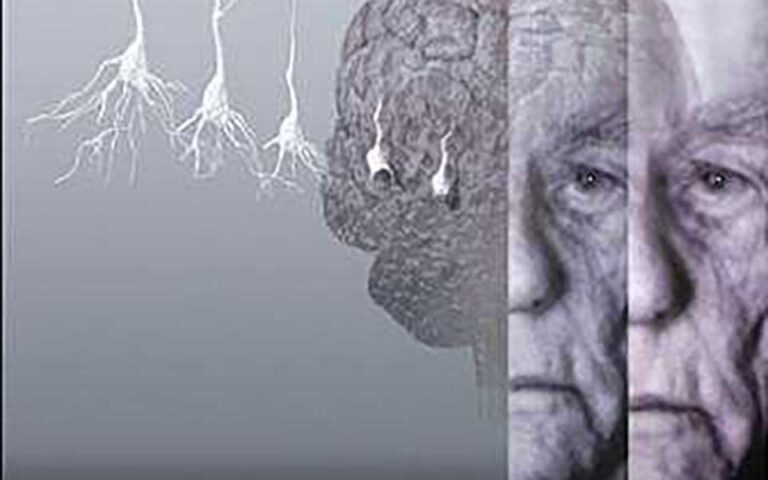مهمترین عوامل خطر دمانس و آلزایمر