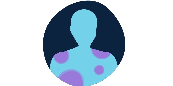 سرطان خون و همه چیز درباره نشانه های آن کبودی یا خونریزی بدون دلیل