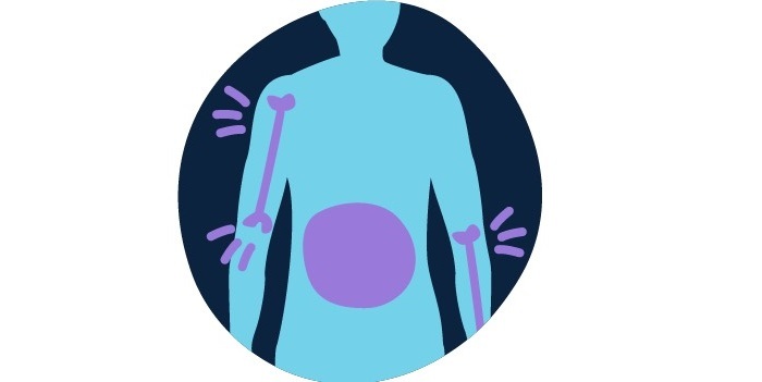 سرطان خون و همه چیز درباره نشانه های آن درد در استخوان، مفاصل یا شکم