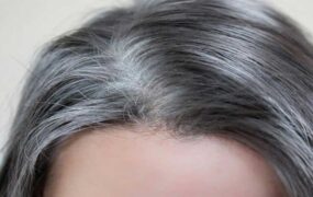 راه‌های جلوگیری از سفید شدن مو‌ها