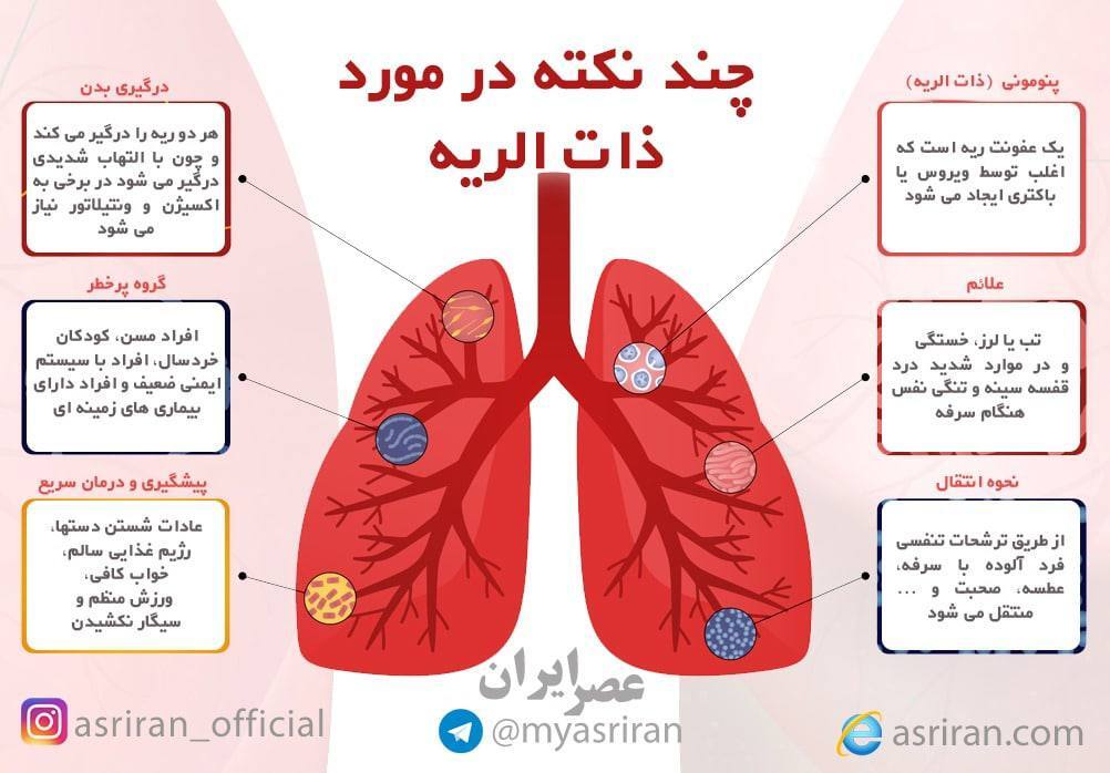 چند نکته درباره ذات الریه