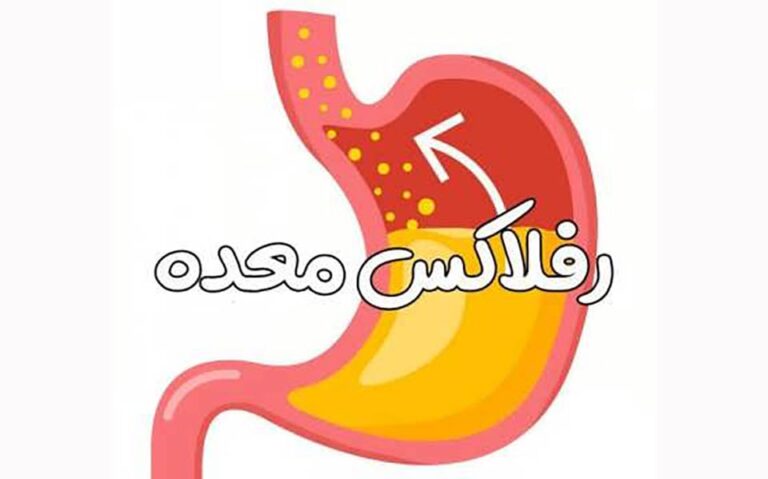 تغییرات سبک زندگی برای درمان رفلاکس معده