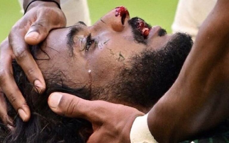 جمجمه شهرانی بازیکن عربستان خرد شد