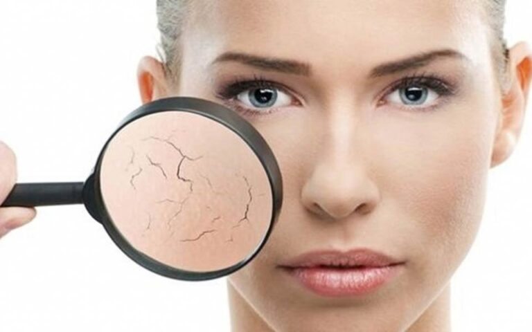 شایع ترین مشکلات پوستی در پاییز