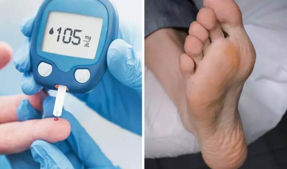 پنج اقدام برای کمک به محافظت از بینایی در طول دیابت