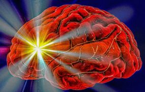 تشخیص سکته مغزی موبایل