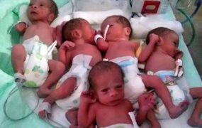 زن گنبدی ۵ قلو به دنیا آورد
