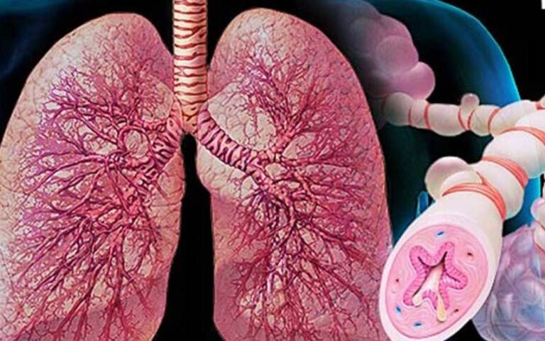 علائم اولیه حمله آسم