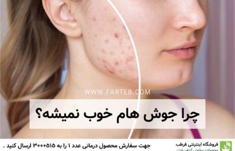 چرا جوش میزنیم