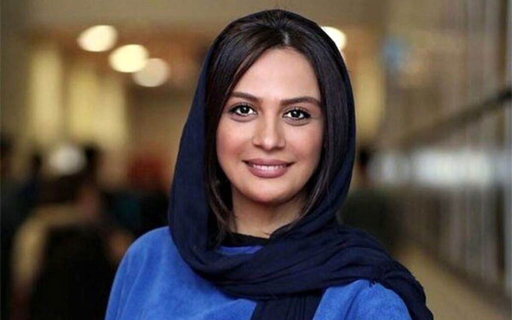 چهره مارال فرجاد بعد از شیمی‌درمانی