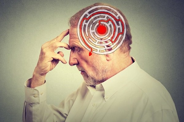 آلزایمر